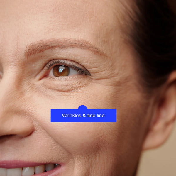 Anti-ageing treatment for fine lines by Lavié Labs