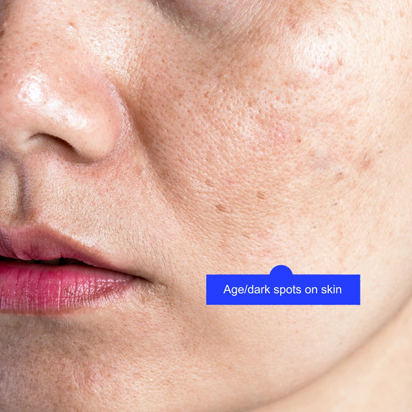 Hyperpigmentation and dark spot treatment by Lavié Labs