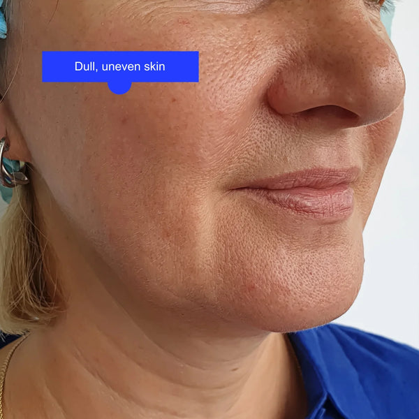 Skin glow and radiance treatment by Lavié Labs