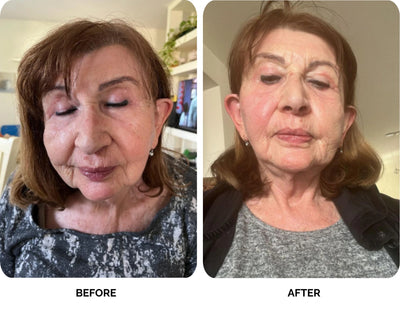Natalia before and after