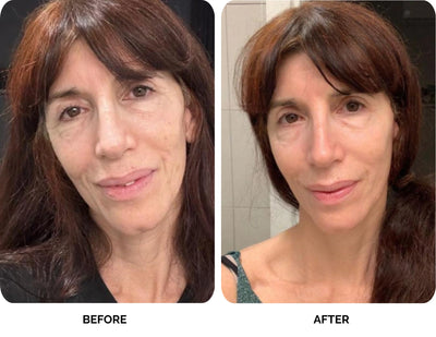 Mandy before and after