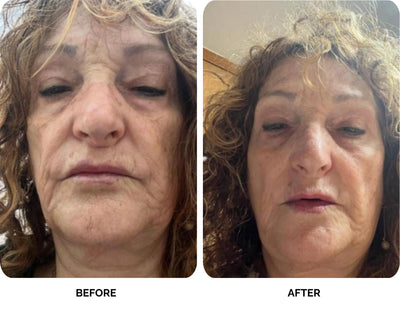 Ruth before and after