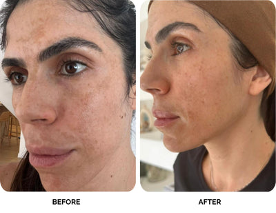 Jeni Levi before and after