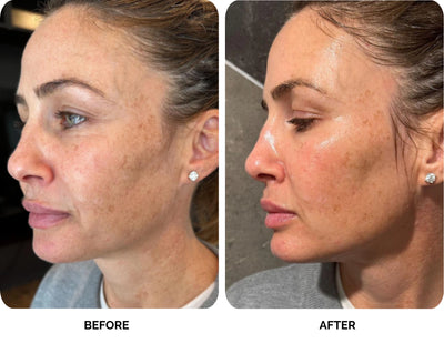 Michelle before and after