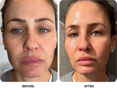 Michelle before and after