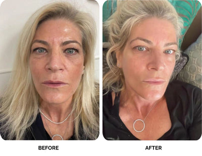 Emma before and after