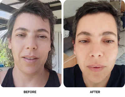 Abbie before and after
